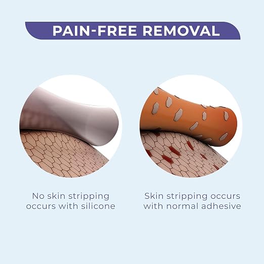 Soft Silicone Tape, Pain-Free Removal, Easy Cut Size, 1" x 4 Yards, 2 Rolls